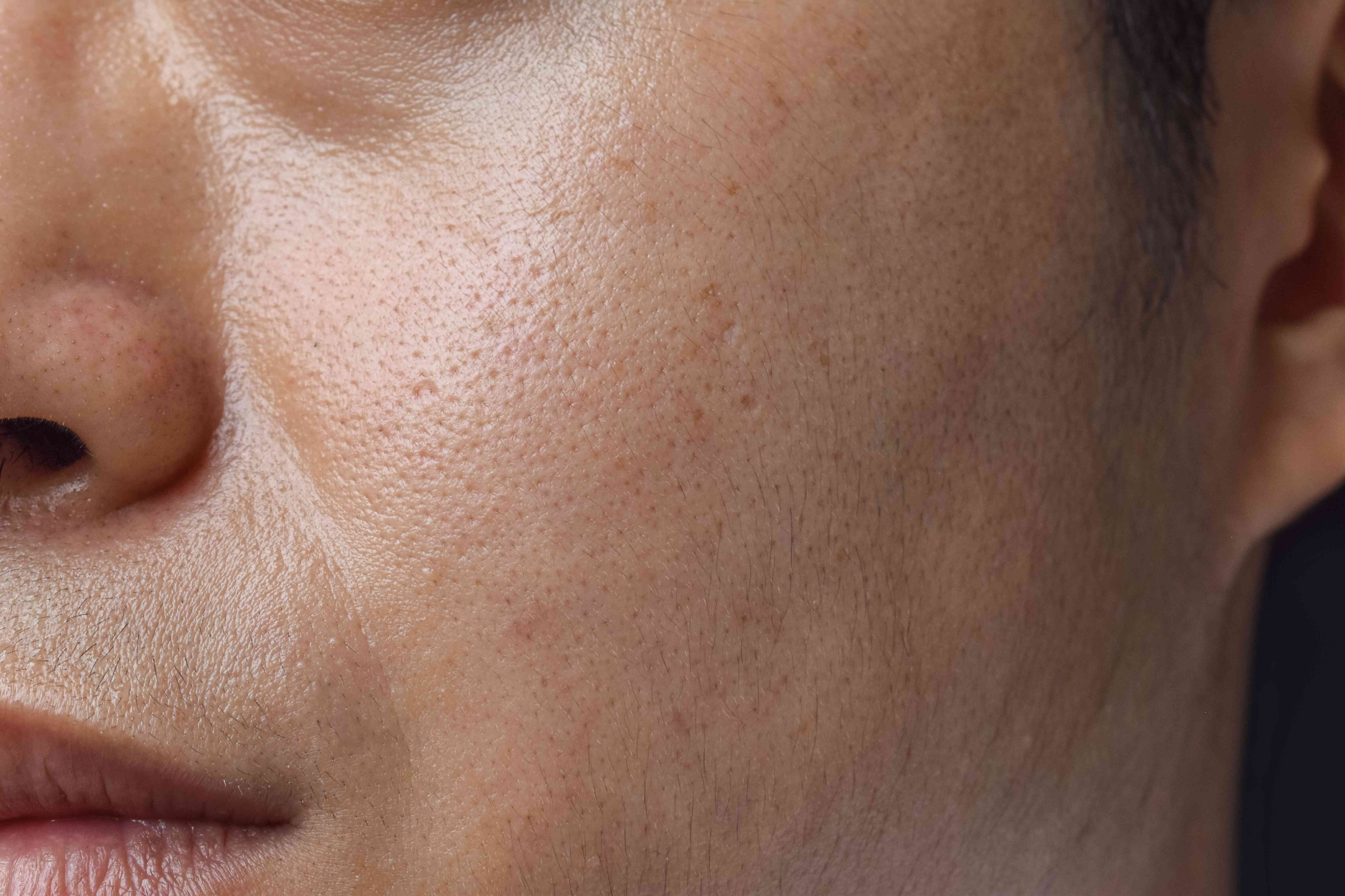 Why You Should Try an Overnight Balm